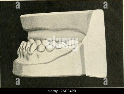 The science and practice of dental surgery. Fig. 2is.—Inferior