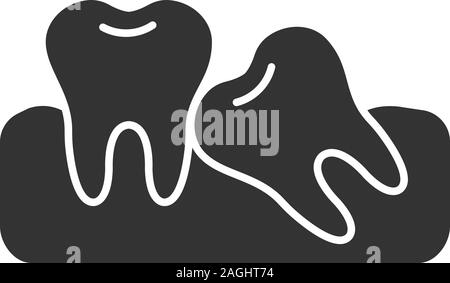 Crooked teeth glyph icon. Malocclusion. Wisdom tooth problem. Silhouette symbol. Negative space. Vector isolated illustration Stock Vector