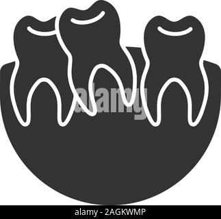 Crooked teeth glyph icon. Malocclusion. Wisdom tooth problem. Silhouette symbol. Negative space. Vector isolated illustration Stock Vector