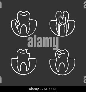 Dentistry chalk icons set. Stomatology. Gum bleeding, toothache, broken tooth, caries. Isolated vector chalkboard illustrations Stock Vector