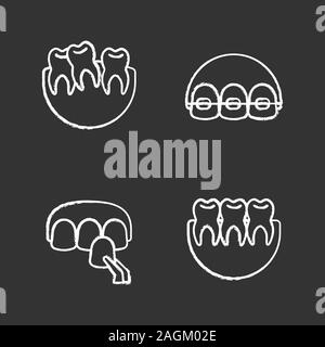 Dentistry chalk icons set. Stomatology. Crooked and healthy teeth, dental braces, veneer. Isolated vector chalkboard illustrations Stock Vector