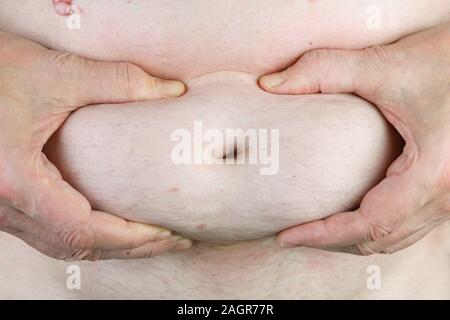 Demonstration of age-related changes - in old elderly  man and women  fat accumulates in the abdomen concept Stock Photo