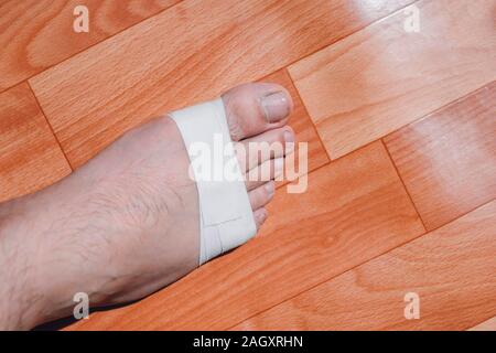 Broken leg. Detail of the leg in plaster of a man sitting. Stock Photo