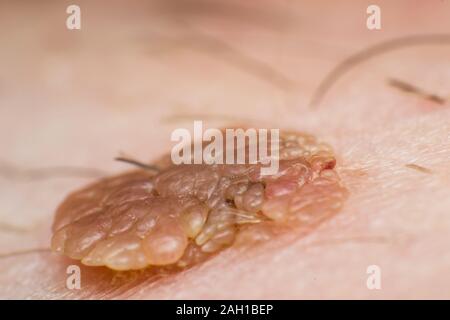 macro medical term macro medical term