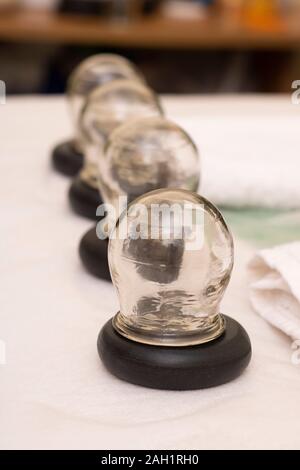 Massage jars for therapeutic massage Stock Photo