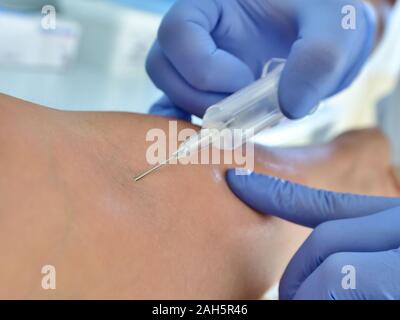 Doctor takes blood from a vein for analysis Stock Photo