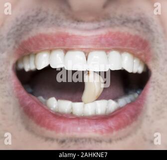 Between a male's teeth, a clove of raw garlic...and bad breath Stock Photo