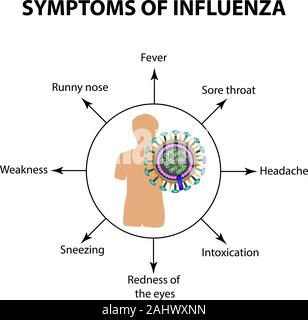 Symptoms Infections of the influenza virus. Infographics. Vector illustration on isolated background Stock Vector