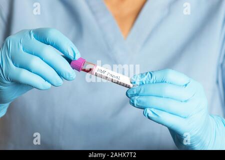 HBV-Hepatitis B Virus blood test tube.  The HBV test can help determine the the hepatits b infection status in patients  before beginning HCV treatmen Stock Photo