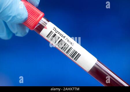 Thyroid panel blood test tube. A thyroid panel is a group of tests that may be helpful in  evaluating thyroid gland function and to diagnose thyroid d Stock Photo