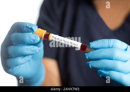 Liver Function Test With Blood Sample Top View Isolated On Black Background Healthcare