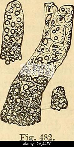 Clinical lectures on the principles and practice of medicine . Pig. 481. BRIGHT S DISEASE. 825. Stock Photo