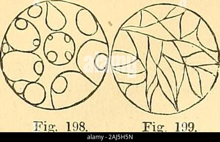 Clinical lectures on the principles and practice of medicine . 200 PRINCIPLES OP MEDICINE.. Fig. 198. Stock Photo