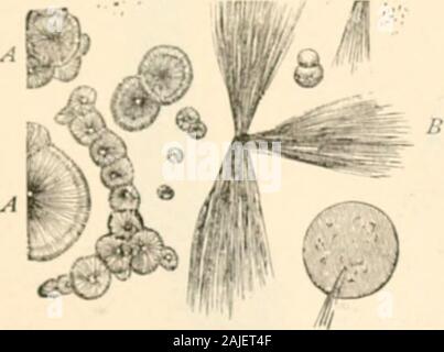 Manual of pathology : including bacteriology, the technic of postmortems, and methods of pathologic research . Fig. 488.a. Lcucin balls h, h. Tyrosin sheaves.. Stock Photo