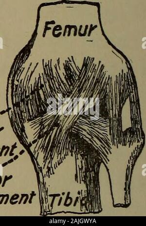 Knee joint showing muscles and ligaments with labels Stock Photo