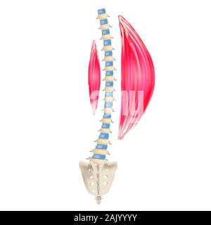 Left-sided scoliosis. Levoscoliosis. Muscles and spine. Spinal curvature in scoliosis. Infographics. Vector illustration on isolated background. Stock Vector