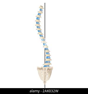 S-shaped scoliosis. Dextroscoliosis. Levoscoliosis. Spinal curvature, kyphosis, lordosis, scoliosis, arthrosis. Infographics. Vector illustration on Stock Vector