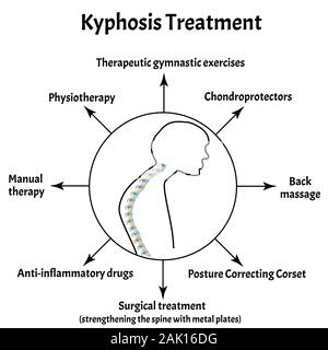 Treatment of lordosis. Spinal curvature, kyphosis, lordosis, scoliosis ...