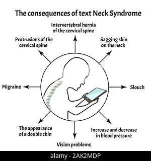 Consequences of Text Neck Syndrome. Spinal curvature, kyphosis, lordosis of the neck, scoliosis, arthrosis. Improper posture and stoop. Infographics Stock Vector