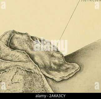 Surgical anatomy : a treatise on human anatomy in its application to ...