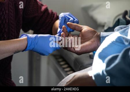 Homelessman giving a blood sample on ‘Find and Treat’ NHS Van that finds homeless people with TB and hepatitis C to give on-the-spot diagnosis, UK Stock Photo