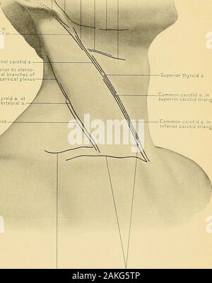 Surgical anatomy : a treatise on human anatomy in its application to the practice of medicine and surgery . 3d portion of subclavian a Facial a. Second portion of lingual a. Common carotid a. insuperior carotid triangle Common carotid a. ininferior carotid triangle. Innominate a. LINES OF.INCISION FOR EXPOSURE OF ARTERIES AND NERVES.67 PLATE CIXV, Posterior auricular artery and mPosterior auricular Stock Photo