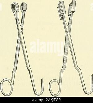 CATHETER IN A BLADDER Stock Photo - Alamy