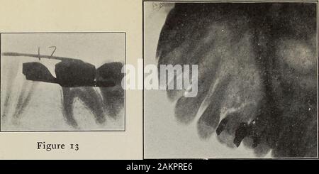 The archives of physiological therapy . Figure 11 Figure 12 Figure 8 ...