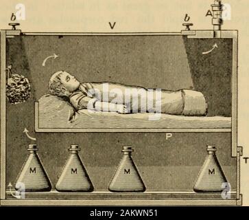 An American text-book of the diseases of children .. . Incubator.b, b, lid with glass plate; r, glass plate ; H, ventilating tube; O, slide closing hot-air chamber; M, hot-water cans. other opening is at one end of the box, closed by a door not fitting tightly, toadmit a small amount of air. The upper part, arranged to receive the infant, Fig. 5.. Interior of Incubator. On the top is also arranged a smallFig. 6. is covered on top by a plate of glass, fitting completely, with two buttons orknobs to admit of its being easily raisedmetal tube containing a small rotary fanvery easily moved by a we Stock Photo