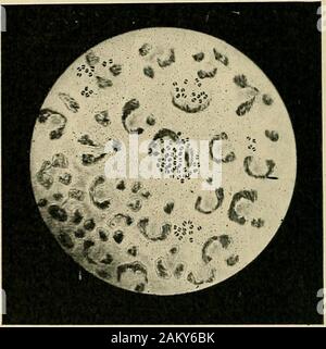 The hygiene of transmissible diseases; their causation, modes of dissemination, and methods of prevention . s, for the reason that they usually defeat the veryobject for which they are employed, by converting the tissuesinto a nidus favorable to the growth of micro-organisms. Bythe action of such substances the vitality of the tissues isoften destroyed through the induction of necrotic changes,and they are in this way deprived of the means with whichnature has endowed them for resisting infection. 140 HYGIENE OF TRANSMISSIBLE DISEASES. VENEREAL DISEASES, ( GoJiofvhea and Syphilis.) Gonorrhea.— Stock Photo