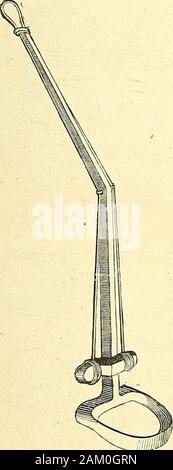 Chirurgie journalière des hopitaux de Paris : répertoire de thérapeutique chirurgicale . Fig. 5S0. — Spéculum deS. Duplay.. Stock Photo