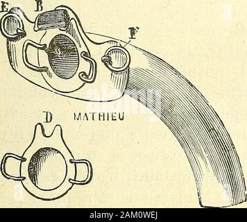 Chirurgie journalière des hopitaux de Paris : répertoire de thérapeutique chirurgicale . Fig. 548. — Modification de Robert et Collin.. Stock Photo