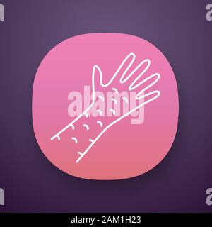 Skin rash, hives app icon. Urticaria, eczema, irritation UI/UX user ...