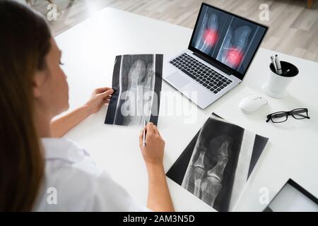 Female Doctor Examining Knee X-ray On Laptop In Clinic Stock Photo