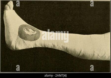 Left leg hi-res stock photography and images - Alamy