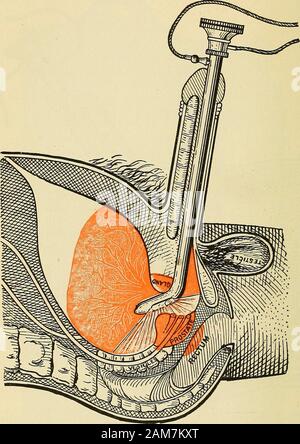 Bisturí Quirúrgico Icono Médico Vector Ilustración Diseño Vector