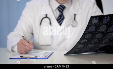 Doctor prescribing medication for brain disease, examining MRI scan, insurance Stock Photo