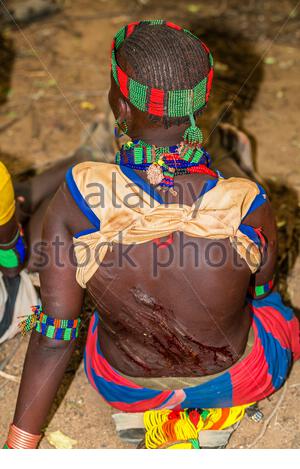 Hamar Tribe Women With Whipped Backs At Bull Jumping Ceremony, Turmi ...