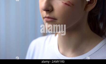 Physician handling wound on female face, scars and treatment after trauma Stock Photo