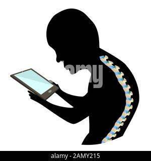 Text Neck Syndrome. Spinal curvature, kyphosis, lordosis of the neck, scoliosis, arthrosis. Improper posture and stoop. Black and white silhouette Stock Vector