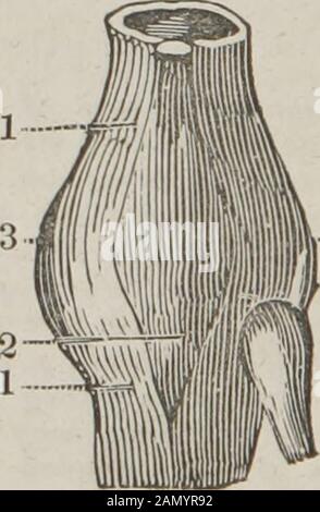 The dissector's guide, or, Student's companion : illustrated by numerous woodcuts, clearly exhibiting and explaining the dissection of every part of the human body . ise the head of the femur over the brim of the acetabulum, and thereduction is in this way accomplished. 4. Method when upon the pubis. — The pelvis being fixed, extensionmay be made upwards and backwards, a towel having been previouslypassed beneath the injured thigh, so as to enable an assistant to raise thethigh during the extension, which will draw the head of the femur overthe brim of the acetabulum. The extension is then to Stock Photo