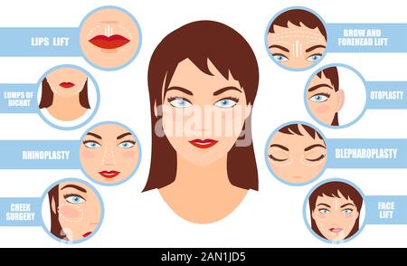 Vector portrait of a woman with plastic surgery infographics rhinoplasty, face lifting, blepharoplasty icons Stock Vector