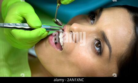 Dentist removing cotton ball from womans patient mouth, isolation from saliva Stock Photo