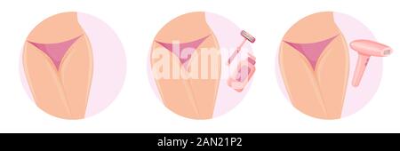 Hair removal bikini razor and laser. Stock Vector