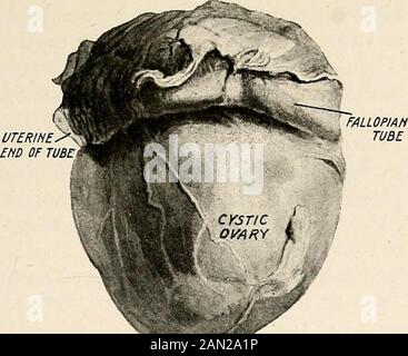 Gynaecology for students and practitioners . INFLAMMATION OF THE ...