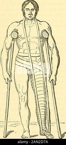 A system of surgery : pathological, diagnostic, therapeutic, and operative . Seutias scissors. Fig. 349. Fig. 350.. Stock Photo