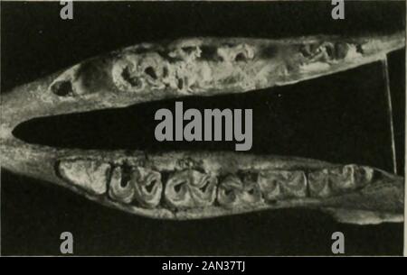 Annals of medical history . FiO. 9. Two views of the mandible of a three-toed horse, MerycbippuS campestris, from the Miocene, aboutone and one-half million yean old. The figures show in the absorbed alveolar margins pathological processessimilar to alveolar pyorrhea of the present day. A left premolar shows evidences of caries, and the swelling inthe left ramus, so evident in the right-hand figure, is indicative of a fistula, possibly indicating the presence ofactinomycosis in the early stages. (Courtesy of Dr. . I). Mather I Studies in Paleopathology 385 Stock Photo