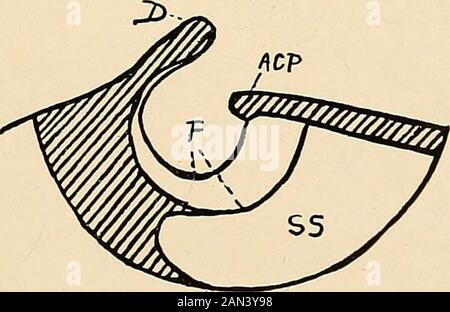 Roentgen diagnosis of diseases of the head . Fig. 42.—Widening of the sella produced by a small intrasellar tumor. D. Dorsumsellte. ACP. Anterior clinoid processes. SS. Sphenoidal sinus.. Fig. 43.—An asymmetrical widening of the sella which was the result of a tumorof the hypophysis that developed asymmetrically. F. Double outline of the floor ofthe sella. D. Dorsum sellx. ACP, Anterior clinoid processes. SS. Sphenoidal sinus. is chiefly discernible at the postmortem by its growth upwardfrom the hypophyseal fossa without erosion of the sella.6 Justas uncertain also is the evidence of a diminut Stock Photo