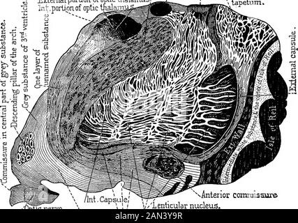 Lectures on localization in diseases of the brain, delivered at the Faculté de médecine, Paris, 1875 . Fig. i8.—Scheme illustrative of the different orders of peduncular fibres.—Huguenin. ments, and to that unequal distribution is due the differencein color of the three segments of the lenticular ganglion. 68 DISEASES OF THE BRAIN. There is no question as to whether the fibres from the footof the peduncle go to the thalami optici; the thalami opticireceive no other fascicuH from the cerebral peduncles exceptthose from the tegmentum. To the fasciculi which go from the foot of the peduncle to