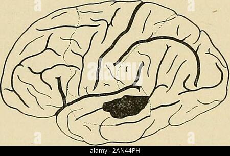 Organic and functional nervous diseases; a text-book of neurology . (Eichhorst.) (Claus.). Stock Photo